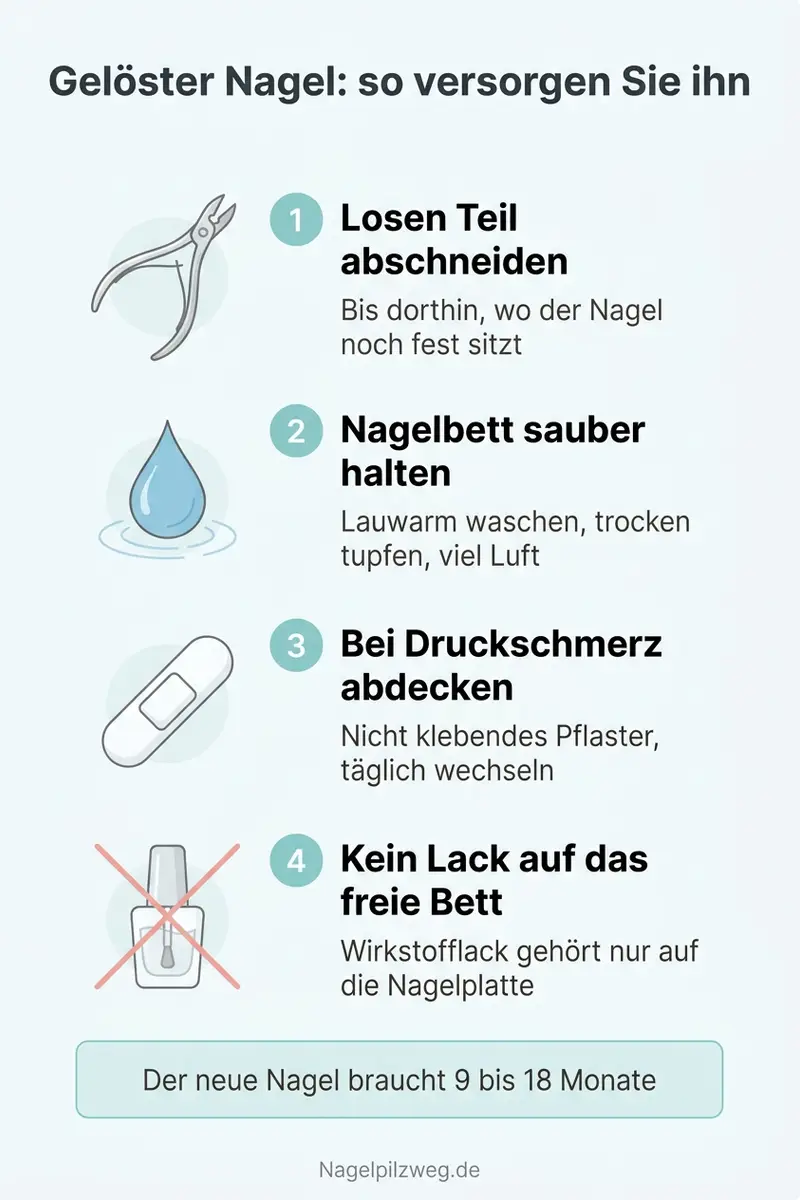Infografik: Gelöster Nagel – so versorgen Sie das Nagelbett