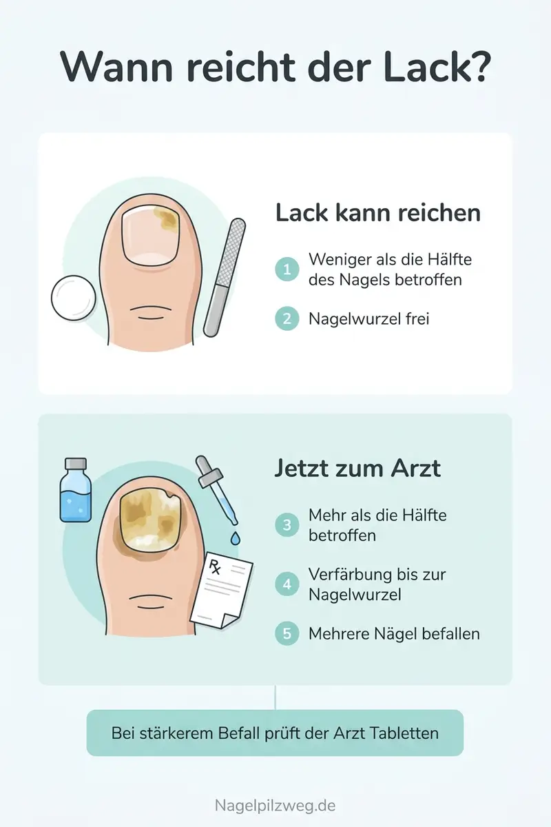 Infografik: Wann Lack reicht und wann Tabletten ins Gespräch gehören
